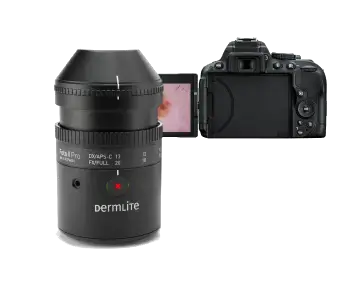 imed, medical, interlinkmedical, dermlite, imed Dermlite, imed products, DermLite Foto II Pro Plus